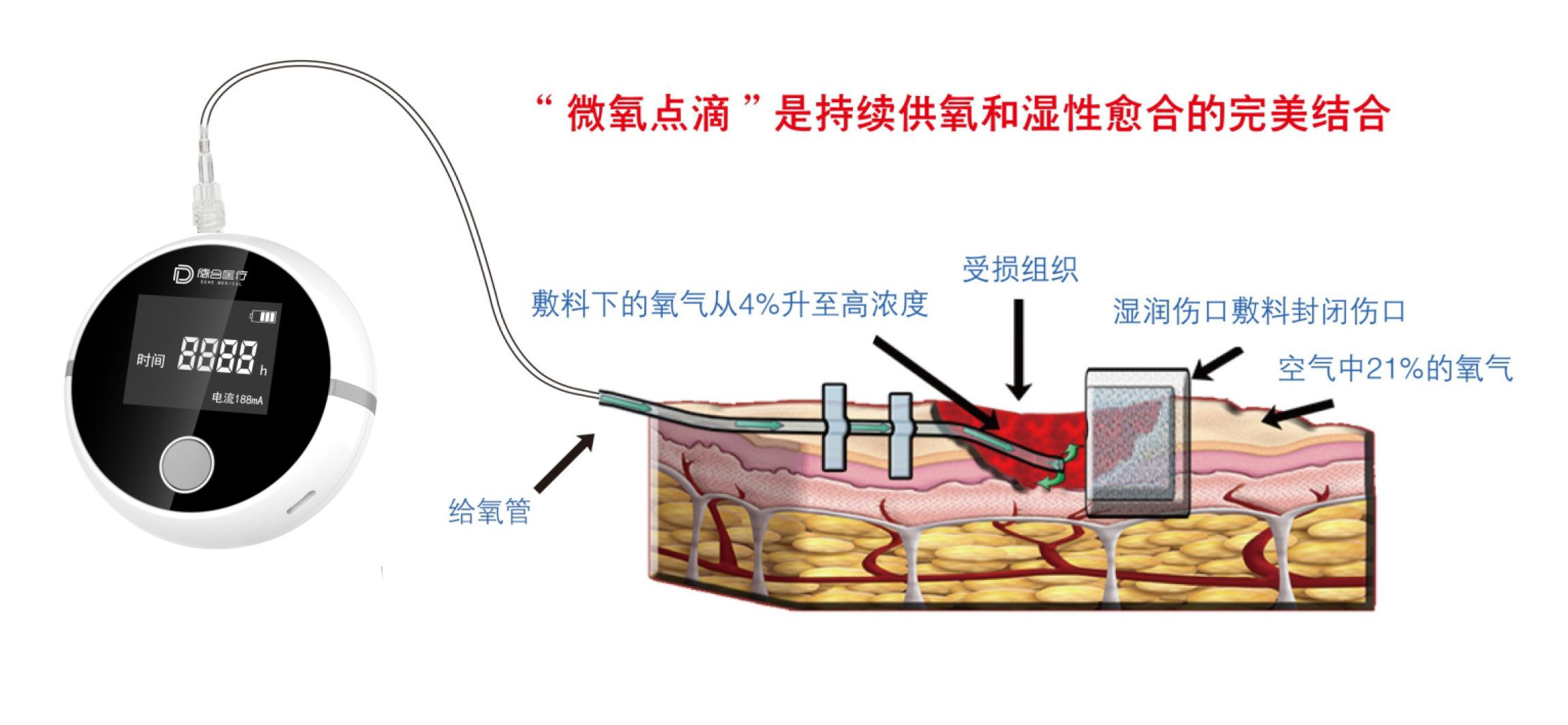 創(chuàng)面氧療儀（二合一）-4_03